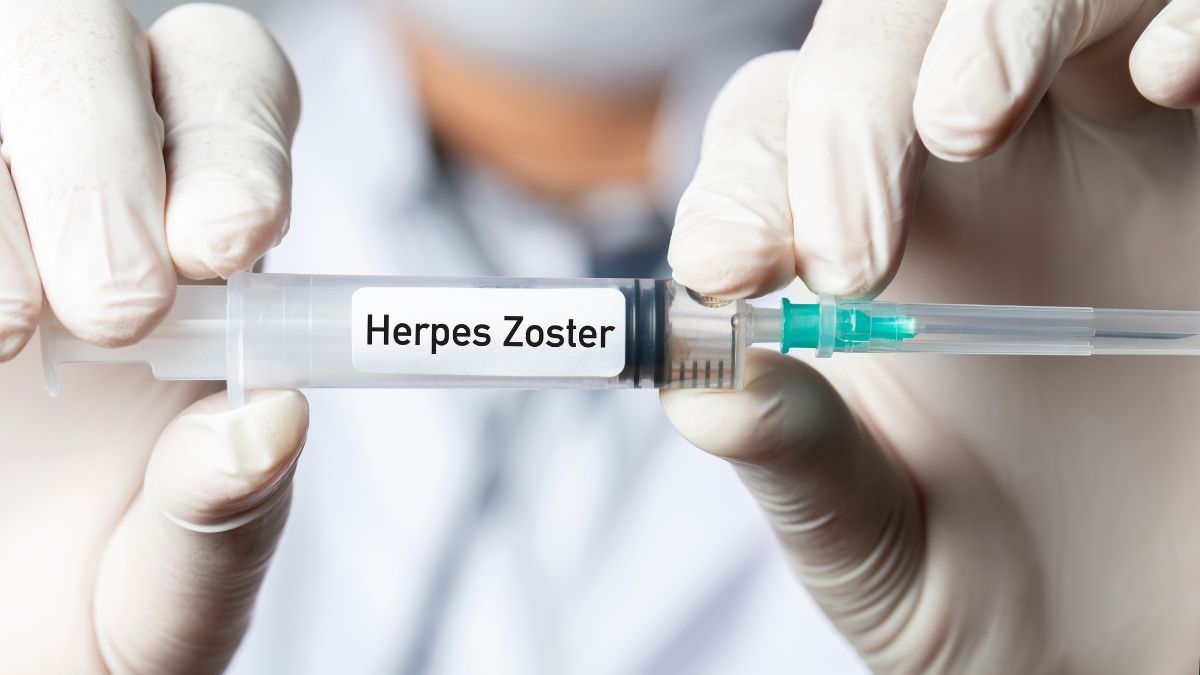 Seputar Vaksin Herpes Zoster