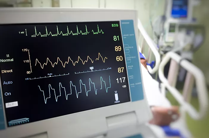 fungsi elektrokardiogram