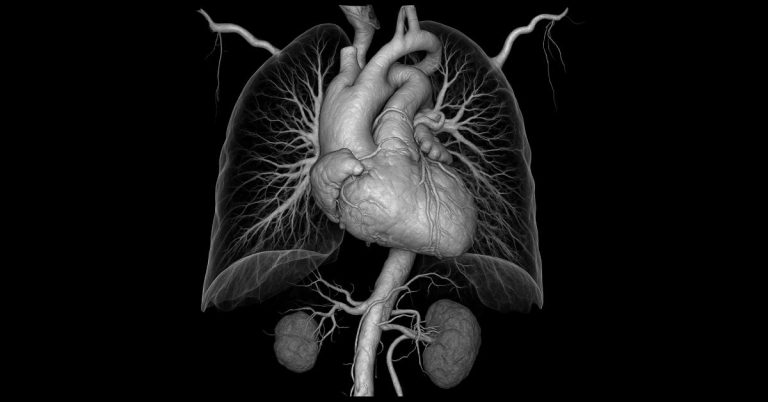 Apa itu Angiography
